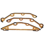Febi Bilstein Gasket Set for Timing Case (181818)